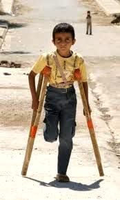 niño-mutilado.jpg