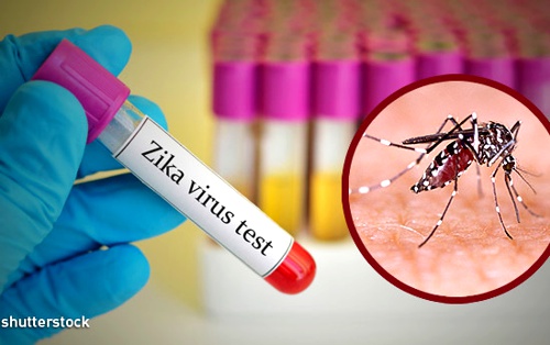 VIRUS-DEL-ZIKA.jpg