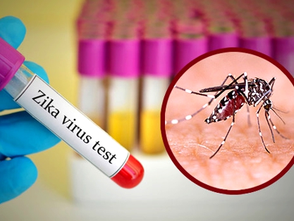 VIRUS DEL ZIKA VIRUS DEL ZIKA
