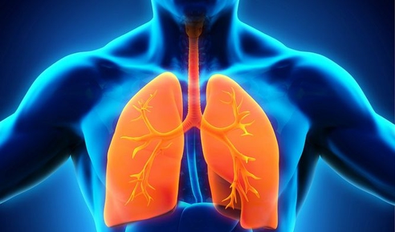 Tuberculosis