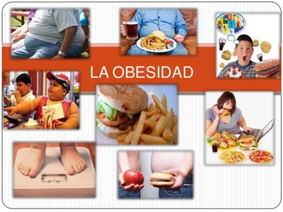 Obesidad.jpg