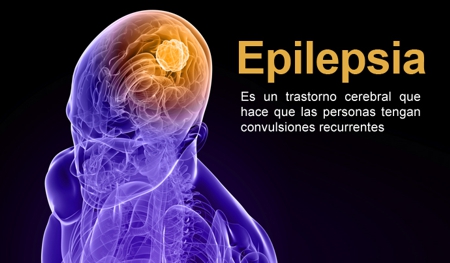 Epilepsia Epilepsia