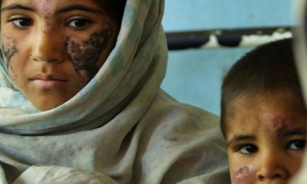 EPM-SE-NIEGA-A-COMBATIR-LA-LEISHMANIASIS-EN-LA-ZONA-DE-HIDROITUANGO.jpg