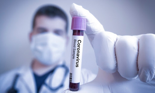 Prueba-Coronavirus.jpg