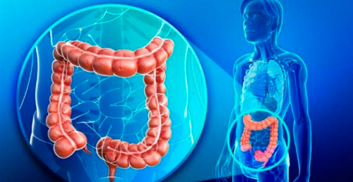 Cáncer-de-colon-La-importancia-de-la-prevención.jpg