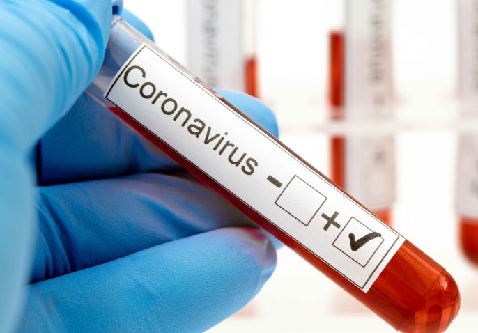 Positivo-Coronavirus.jpg