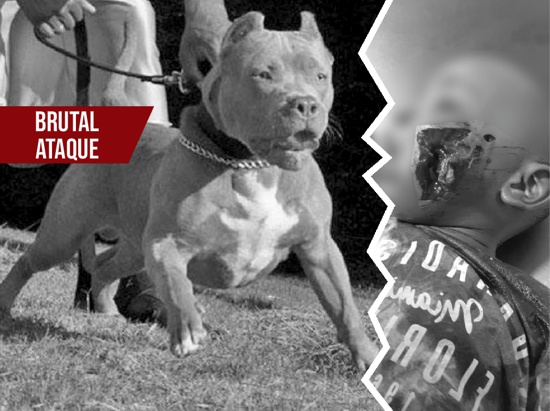 Brutal-ataque-de-perro-pitbull-a-un-nino-en-Puerto-Tejada-Cauca.jpg
