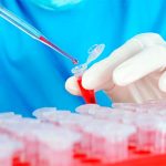 La Mielofibrosis, un cáncer raro y silencioso de la sangre