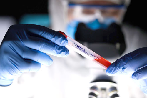 7-Municipios-bajo-vigilancia-epidemiologica-por-incremento-de-contagios.jpg