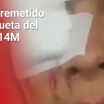 "Con el ojo que veo, sigo viendo un mejor país": Ortega