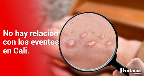 Se-confirma-primer-caso-símico-en-Cali-1