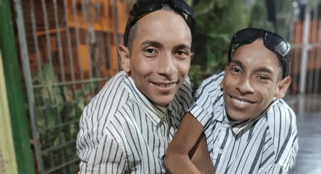Siameses ecuatorianos murieron en Colombia a los 27 años
